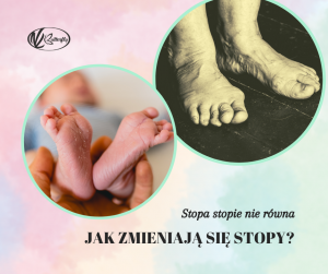 Read more about the article Stopa stopie nierówna