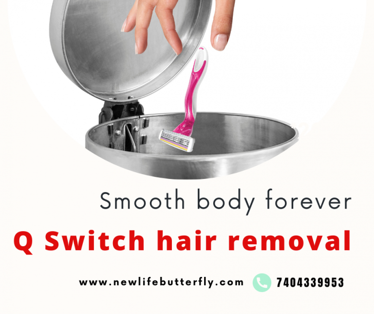 q-swith-hair-removal-featherstone