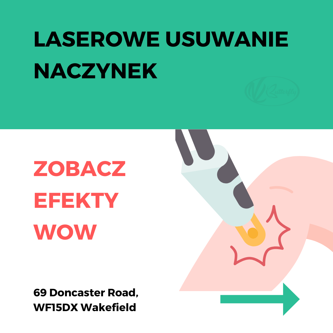 Read more about the article Laserowe usuwanie naczynek – Wakefield