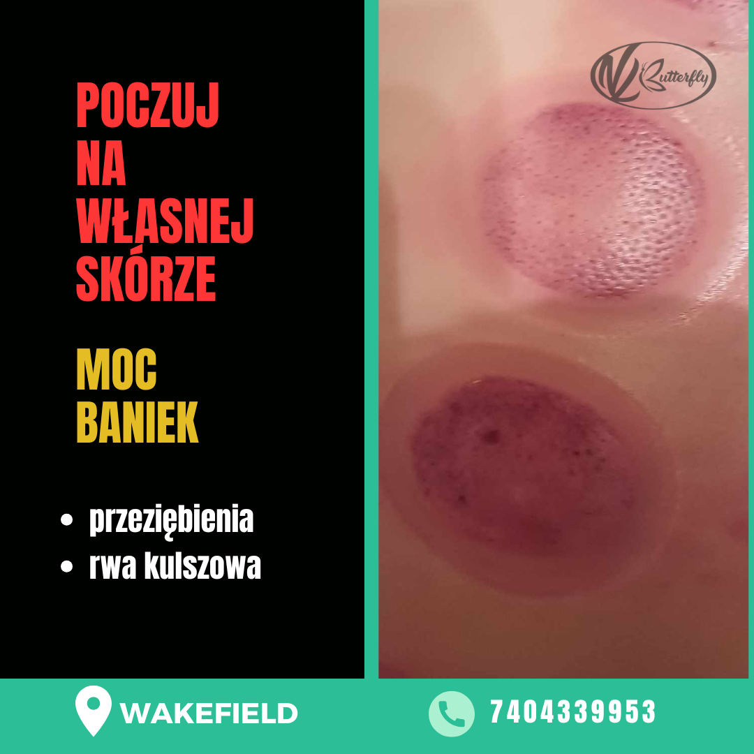 Read more about the article Poczuj na własnej skórze moc baniek