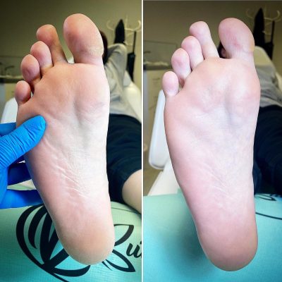 foot pedicure